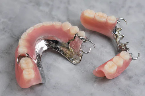 partial dentures Partial dentures