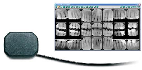 digital dental xray